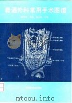 普通外科常用手术图谱（1993 PDF版）