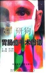 胃肠癌手术图谱 1997 PDF电子版封面 7506716038 李乃卿主编