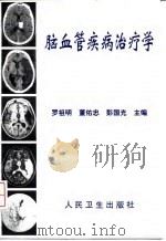 脑血管疾病治疗学（1999 PDF版）