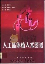 人工晶体植入术图谱 1998 PDF电子版封面 7117029196 袁佳琴主编;黄阿良绘