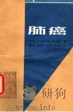 肺癌 第二届世界肺癌会议 哥本哈根 1984 PDF电子版封面 14048·4458 (丹)汉森(H.H.Hansen),(丹)路斯(M,Rφrt