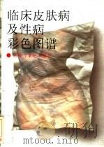 临床皮肤病及性病彩色图谱（1995 PDF版）