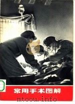 常用手术图解 1970 PDF电子版封面 14.4.122 上海第二医学院《常用手术图解》编写组编
