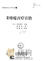 图解痔疮百疗百治（1998 PDF版）