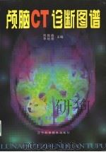 颅脑CT诊断图谱 1998 PDF电子版封面 7538126902 刘振春,刘培基主编