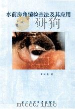 水前房角镜检查法及其应用（1987 PDF版）