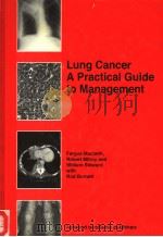 LUNG CANCER A PRACTICAL GUIDE TO MANAGEMENT PDF电子版封面 3718658593 FERGUS MACBETH ROBERT MILROY W