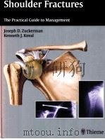 Shoulder Fractures The Practical Guide to Management PDF电子版封面 1588903109 Joseph D.Zuckerman Kenneth J.