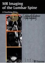 MR Imaging of the Lumbar Spine     PDF电子版封面  3131300914   