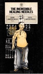THE INCREDIBLE HEALING NEEDLES（ PDF版）