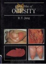COLOR ATLAS OF OBESITY 1991 PDF电子版封面 0801662966 R.T.JUNG