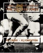 CLINICAL EXAMINATION OF THE INJURED KNEE（1987 PDF版）