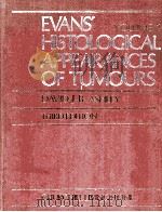 EVANS' HISTOLOGICAL APPEARANCES OF TUMOURS VOLUME 1 THIRD EDITION 1978 PDF电子版封面 044301762X