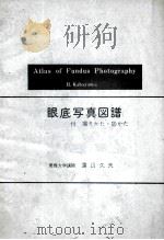 眼底写真图谱 付 撮クかた·诊かた atlas of fundus photography PDF电子版封面